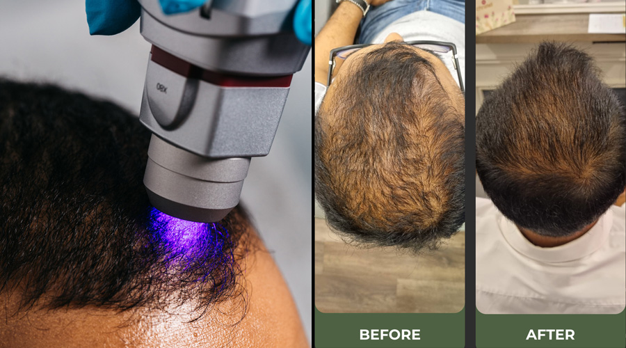 Christell Luxury Wellness Unveils Sri Lankas First Ever Specialty Hair Restoration Clinic with Advanced Regenerative Therapies Image 1