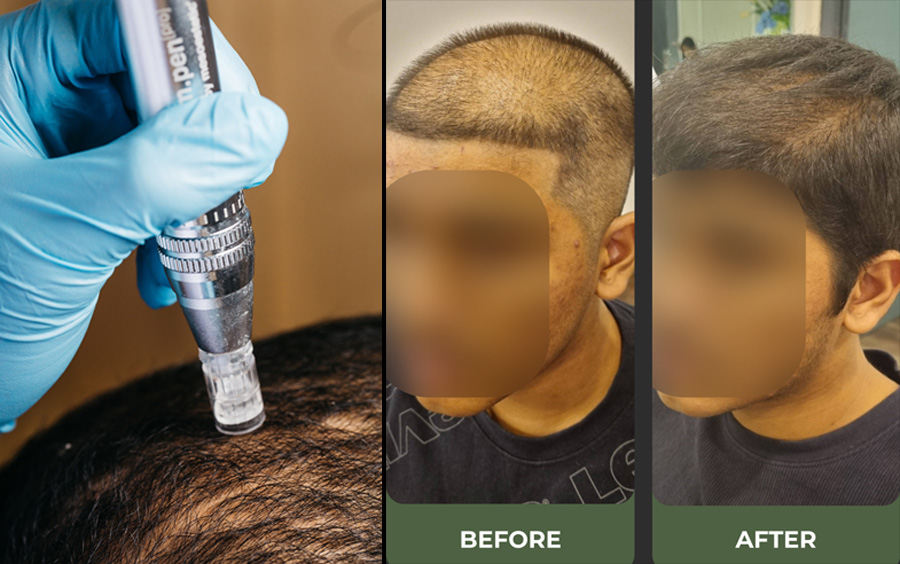 Christell Luxury Wellness Unveils Sri Lankas First Ever Specialty Hair Restoration Clinic with Advanced Regenerative Therapies Image 2
