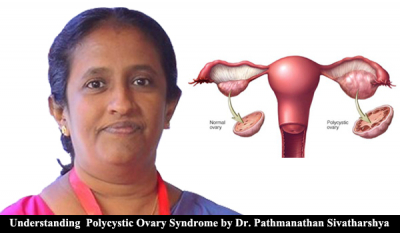 Understanding  Polycystic Ovary Syndrome (PCOS) by Dr. Pathmanathan Sivatharshya
